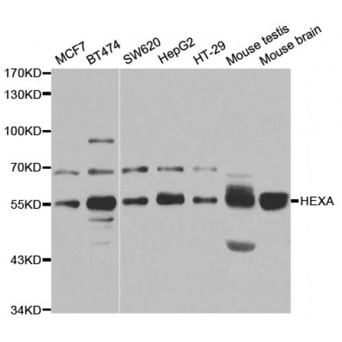Beta-Hexosaminidase Subunit Alpha (HEXA) Antibody
