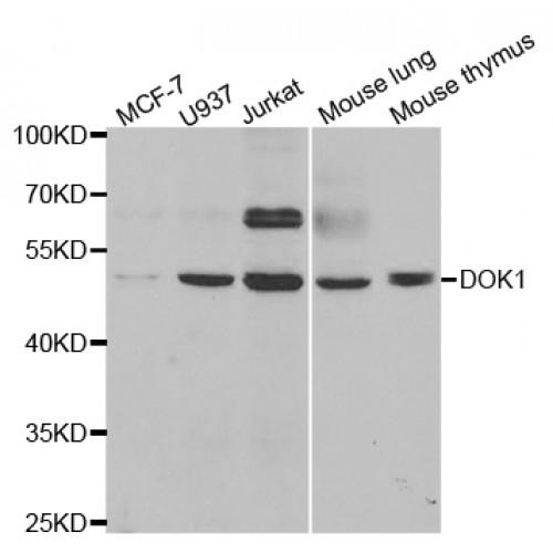 Docking Protein 1 (DOK1) Antibody