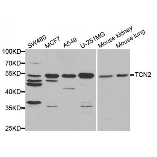 Transcobalamin-2 (TCN2) Antibody