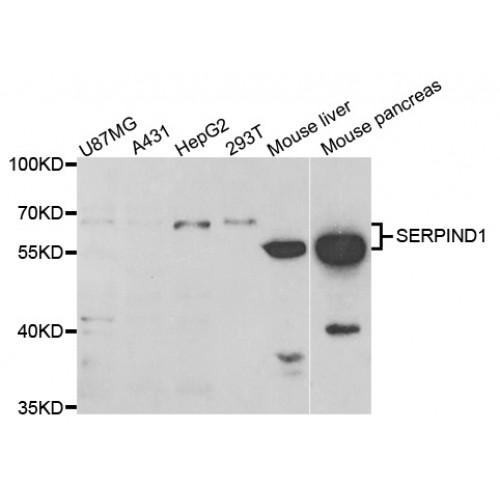 Serpin D1 (SERPIND1) Antibody