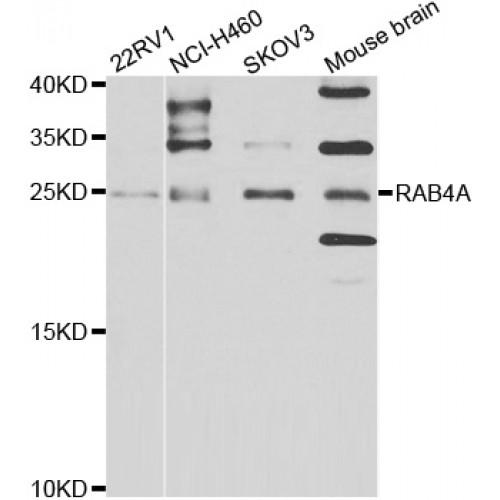Ras-Related Protein Rab-4A (RAB4A) Antibody