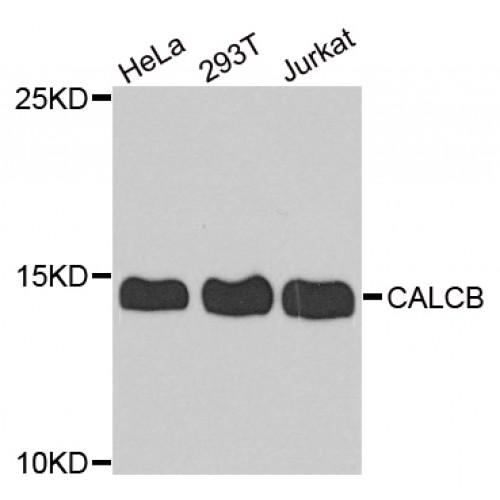 Calcitonin Gene Related Peptide 2 / CGRP2 (CALCB) Antibody