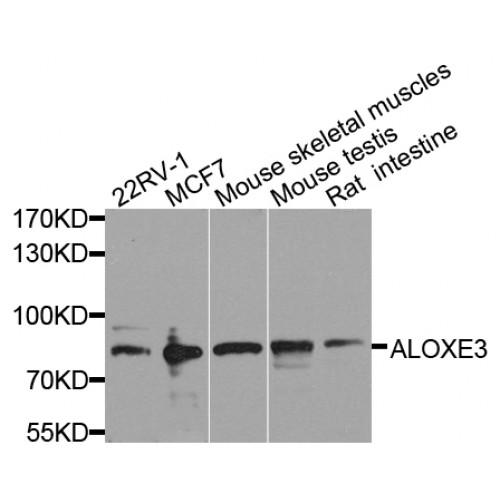 Hydroperoxide Isomerase ALOXE3 (ALOXE3) Antibody