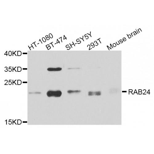 RAB24, Member RAS Oncogene Family (RAB24) Antibody