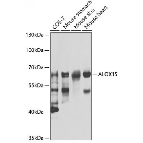 Polyunsaturated Fatty Acid Lipoxygenase ALOX15 (ALOX15) Antibody