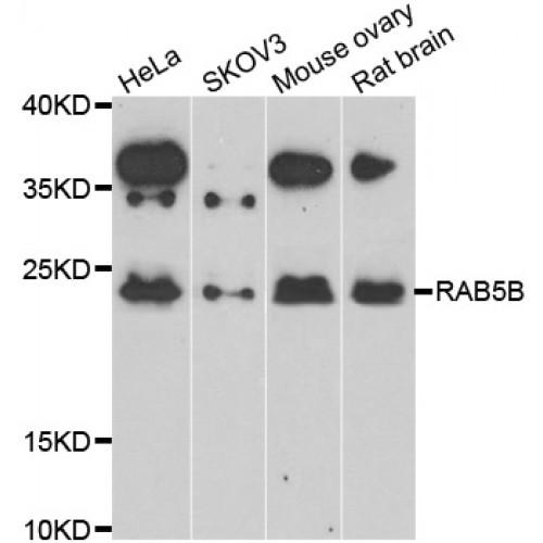 RAB5B, Member RAS Oncogene Family (RAB5B) Antibody