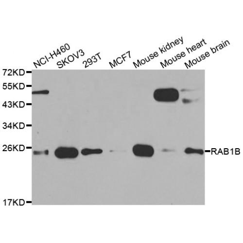 RAB1B, Member RAS Oncogene Family (RAB1B) Antibody