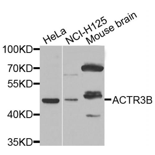 Actin-Related Protein 3B (ACTR3B) Antibody