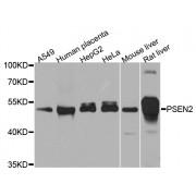 Presenilin 2 (PSEN2) Antibody
