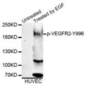 Vascular Endothelial Growth Factor Receptor 2 / VEGFR2 Phospho-Tyr996 (KDR pY996) Antibody
