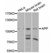 Beta-Amyloid Precursor Protein (APP) Antibody