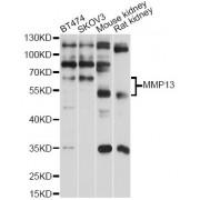 Matrix Metalloproteinase 13 (MMP13) Antibody