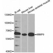 Matrix Metalloproteinase-9 (MMP9) Antibody