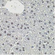Myc Proto-Oncogene Protein (MYC) Antibody