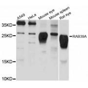 RAB39A, Member RAS Oncogene Family (RAB39A) Antibody
