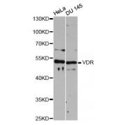 Vitamin D3 Receptor (VDR) Antibody