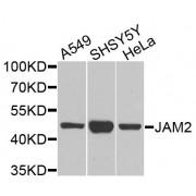 Junctional Adhesion Molecule 2 (JAM2) Antibody