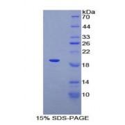 Human Adrenergic Receptor Alpha 1A (ADRa1A) Protein