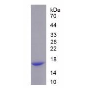 Rat Aggrecan Core Protein (ACAN) Protein