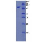 Human Beta-Amyloid Precursor Protein (APP) Protein