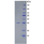 Mouse Beta-Amyloid Precursor Protein (APP) Protein