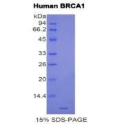 Human Breast Cancer Susceptibility Protein 1 (BRCA1) Protein
