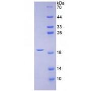 Human Calcitonin Gene Related Peptide 2 / CGRP2 (CALCB) Protein
