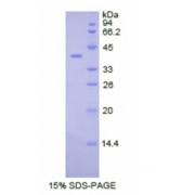 Human Colony Stimulating Factor 2 Receptor Beta (CSF2Rb) Protein