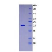 Rat Interleukin 1 Beta (IL1b) Protein