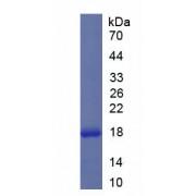 Human Interleukin 1 Delta (FIL1d) Protein