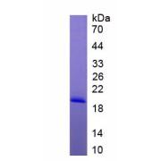 Human Interleukin 36 Gamma / IL1F9 (IL36G) Protein