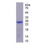 Human Interleukin 17C (IL17C) Protein