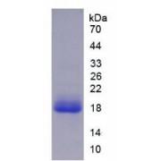Human Interleukin 18 (IL18) Protein