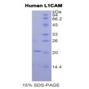 Human L1-Cell Adhesion Molecule (L1CAM) Protein