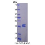 Rat Matrix Metalloproteinase 13 (MMP13) Protein