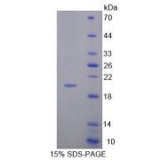 Rabbit Matrix Metalloproteinase 13 (MMP13) Protein