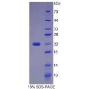 Human Beta-Microseminoprotein (MSMB) Protein