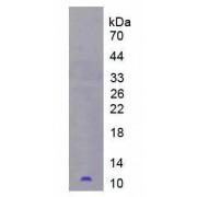 Human Peptidase Inhibitor 3, Skin Derived (PI3) Protein