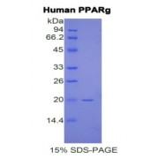 Human Peroxisome Proliferator Activated Receptor Gamma (PPARg) Protein