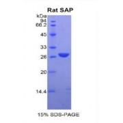 Rat Serum Amyloid P Component (SAP) Protein