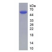 Human Serum Amyloid P Component (SAP) Protein
