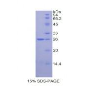 Rat Metalloproteinase Inhibitor 3 (TIMP3) Protein