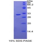 Mouse Toll Interacting Protein (TOLLIP) Protein
