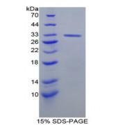 Rat Topoisomerase II (TOP2) Protein