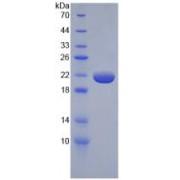 Rat Tumor Necrosis Factor (TNF) Protein