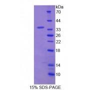 Rat Vascular Endothelial Growth Factor Receptor 2 / VEGFR2 (KDR) Protein