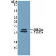 Ficolin 2 (FCN2) Antibody