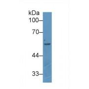 Angiopoietin 2 (ANGPT2) Antibody