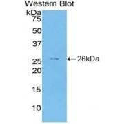 Pentraxin 3 (PTX3) Antibody