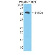 Amyloid Beta 40 (Abeta40) Antibody
